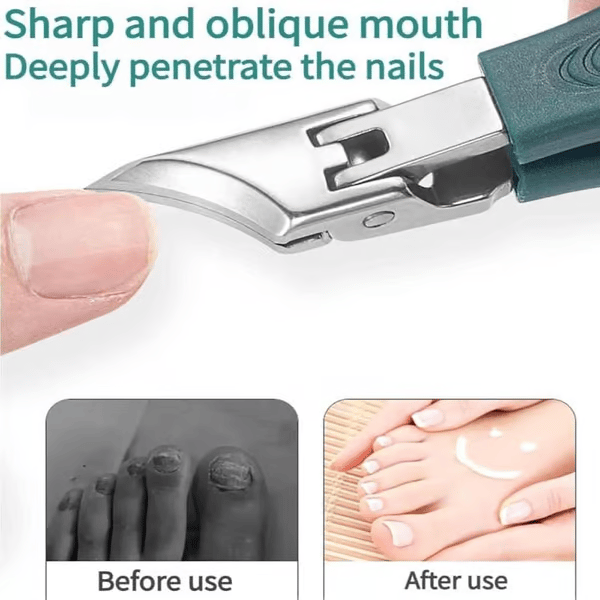 🔥Cortaúñas recomendado por podólogos 🛡️- Diseño ergonómico en ángulo para uñas de los pies y uñas encarnadas-ES